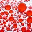 Hematologic Malignancies