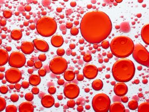 Hematologic Malignancies