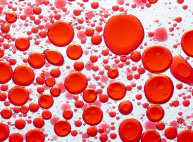 Hematologic Malignancies