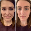 Prp Treatment in Dubai