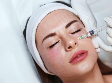 Mesotherapy in Dubai