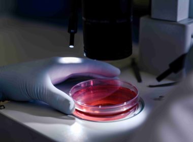 Human Biospecimens and Their Impact on Clinical Trials in the Pharma Industry
