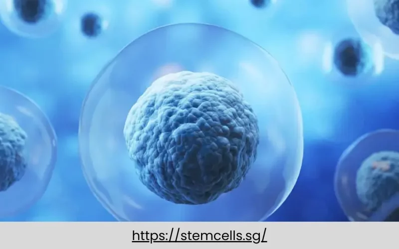 Allogeneic Stem Cell Therapy: