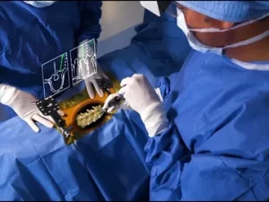 Invasive Spine Surgery