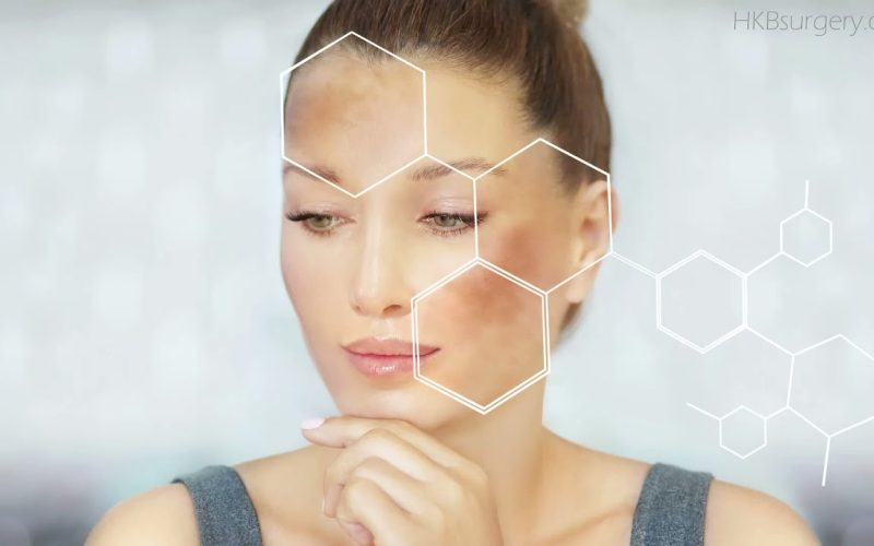 Lichen Planus Natural Healing Remedies