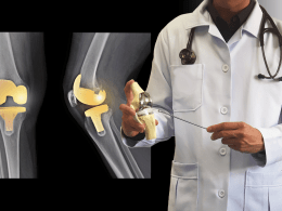 Joint Replacement Surgeon in Patna: Ortho Patna Clinic