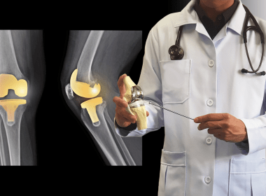 Joint Replacement Surgeon in Patna: Ortho Patna Clinic