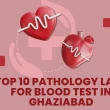 Top 10 Pathology Labs for Blood Test in Ghaziabad (3)