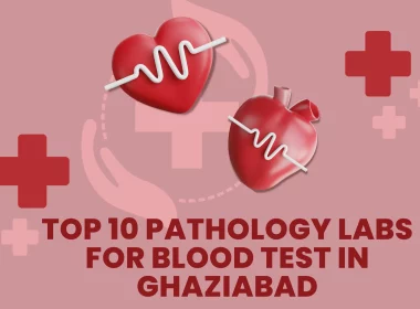 Top 10 Pathology Labs for Blood Test in Ghaziabad (3)