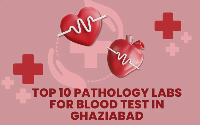 Top 10 Pathology Labs for Blood Test in Ghaziabad (3)