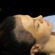 FUE Hair Transplant in Islamabad