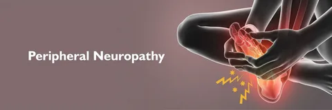 Neuropathy Treatment