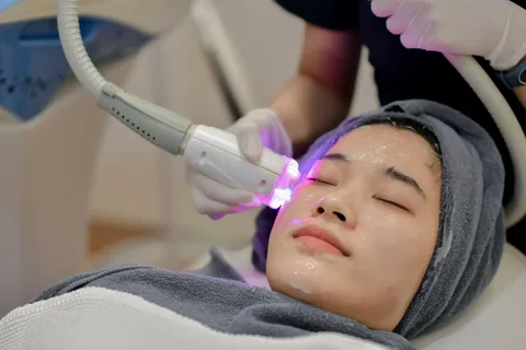 Skin Whitening Treatments