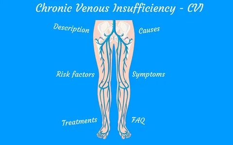 Chronic venous insufficiency