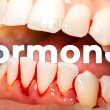 Hormonal Imbalance Ruining Your Teeth? Here's How to Fix It