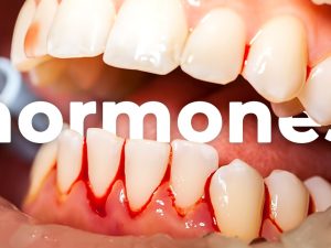 Hormonal Imbalance Ruining Your Teeth? Here's How to Fix It