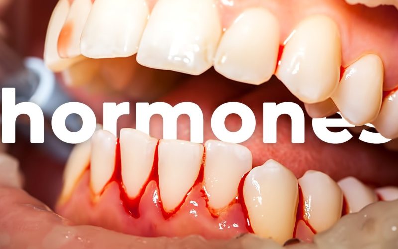 Hormonal Imbalance Ruining Your Teeth? Here's How to Fix It