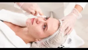 Acne Treatment