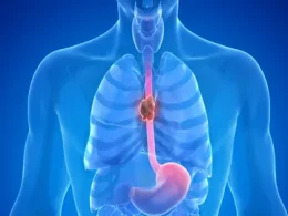 oesophageal health