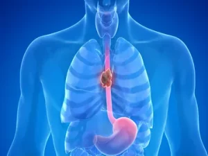oesophageal health