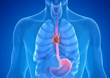 oesophageal health