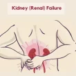 Chronic Kidney Disease