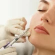 Dermal fillers