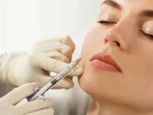 Dermal fillers