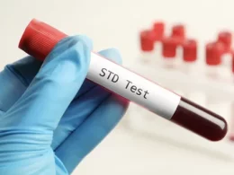 STD Test in Dubai