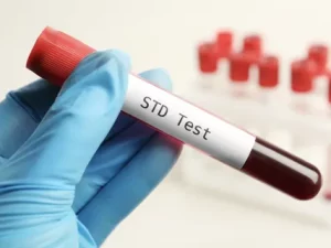 STD Test in Dubai