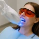 laser whitening