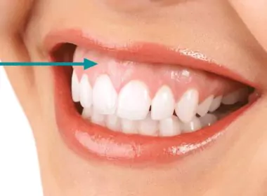healthy gums signs