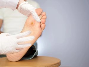 foot lesion