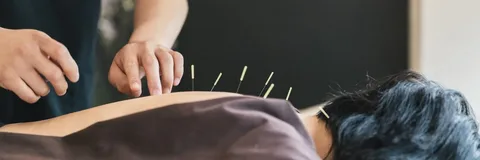 acupuncture in Newport Beach