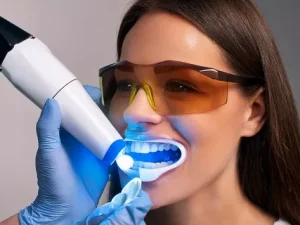 Teeth Whitening