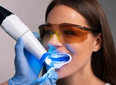 Teeth Whitening