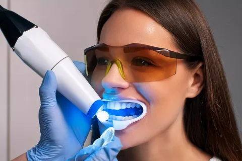 Teeth Whitening