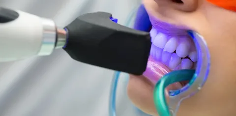 Teeth Whitening