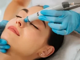acne treatment