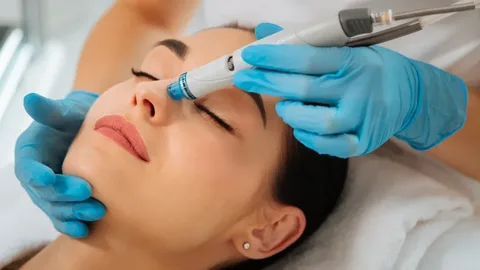 acne treatment