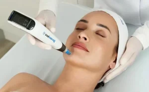 acne treatment