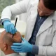 Hair Transplant