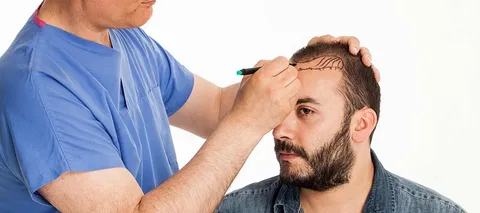 Hair Roots Treatment