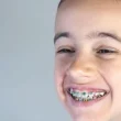 Orthodontic Treatment