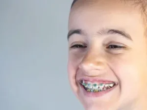 Orthodontic Treatment