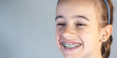 Orthodontic Treatment
