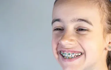 Orthodontic Treatment