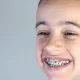 Orthodontic Treatment